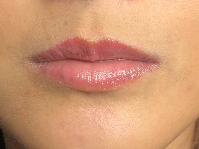 mlfc-lip-tattoo-procedure-after-1-week
