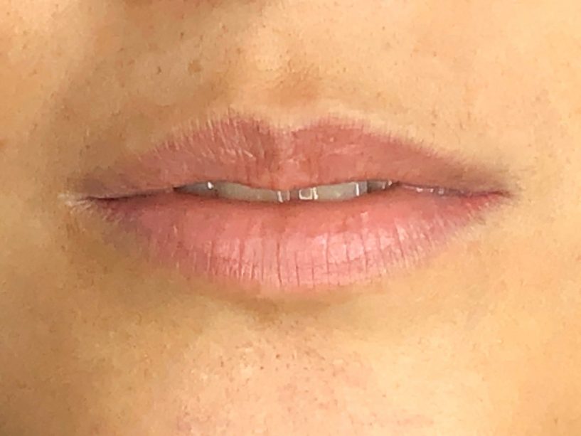 mlfc-lip-tattoo-before